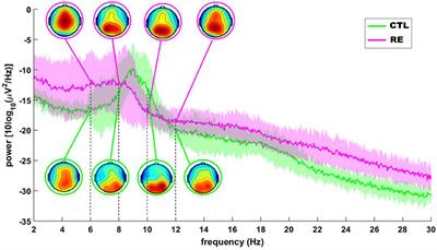 Dynamic coupling between the central and autonomic cardiac nervous systems in patients with refractory epilepsy: A pilot study